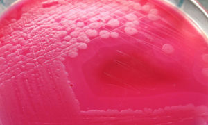 Microbial Analysis